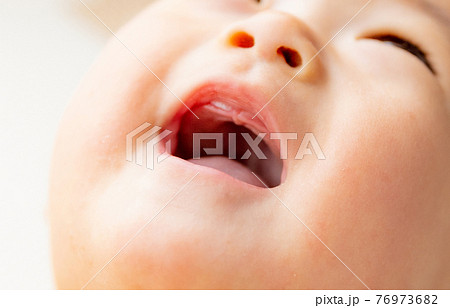 乳歯が生えてきた赤ちゃん 乳歯が生えてきた赤ちゃん 76973682