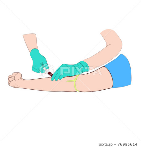 Vector illustration image a doctor using a needle to draw blood from an investigator To check the body 76985614