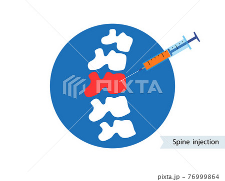Spine joint injection  76999864