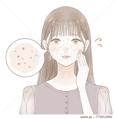 皮脂毛穴に悩む女性 皮脂毛穴に悩む女性 77001890