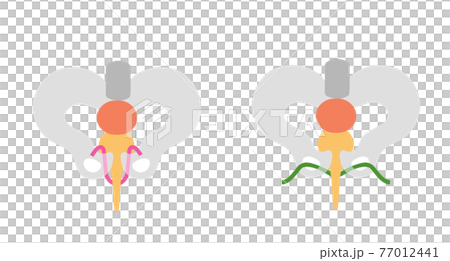 Urinary incontinence medical illustration material for TVT surgery and TOT surgery 77012441