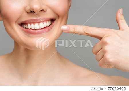 Perfect healthy teeth smile of a young woman. Teeth whitening. Dental care, stomatology concept. 77020406