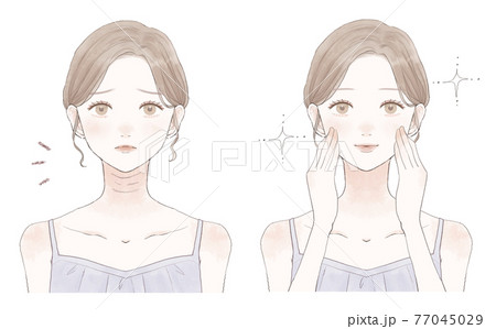 首のしわに悩む女性のビフォーアフター 77045029