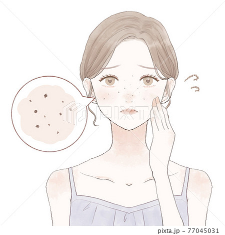 黒ずみ毛穴に悩む女性 77045031
