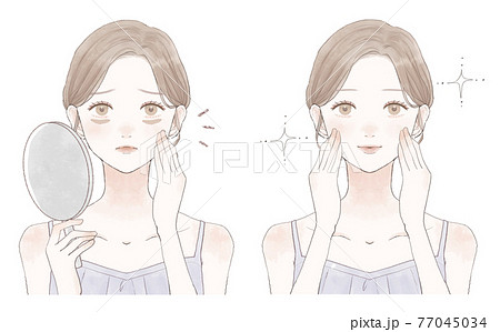 血行不良による目の下のクマに悩む女性のビフォーアフター 血行不良による目の下のクマに悩む女性のビフォーアフター 77045034