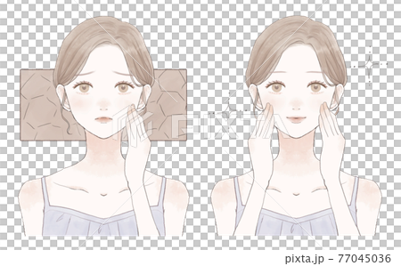 Before and after for women suffering from dry skin Before and after for women suffering from dry skin 77045036