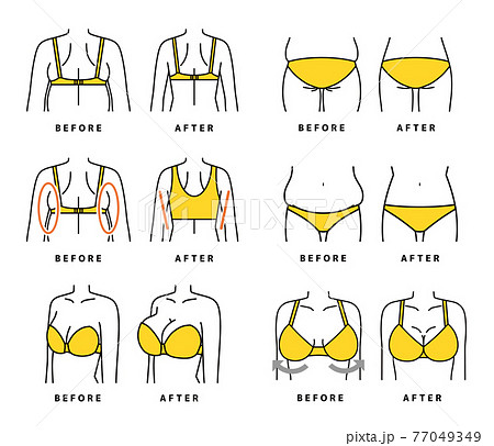 バストUPあんどダイエット ダイエット バストアップ 補整下着 セットのイラスト素材 [77049349