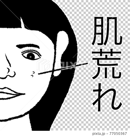 皮膚粗糙 皮膚粗糙 77050367