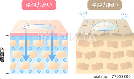 浸透力の高い肌と低い肌 断面図 浸透力の高い肌と低い肌 断面図 77058800