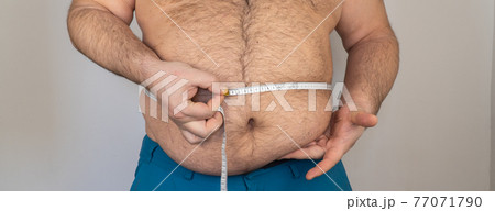 fat man measures the size of the abdomen with a centimeter measuring tape. person is overweight, he is obese. fat man measures the size of the abdomen with a centimeter measuring tape. person is overweight, he is obese. 77071790