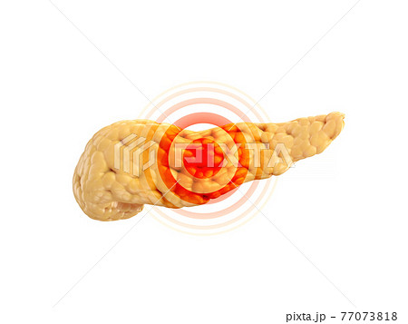 Disease or pain concept of human pancreas isolated on white. 3d illustration  77073818