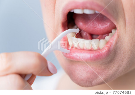 Caucasian woman brushing teeth with toothpick with dental floss on white background. Caucasian woman brushing teeth with toothpick with dental floss on white background. 77074682