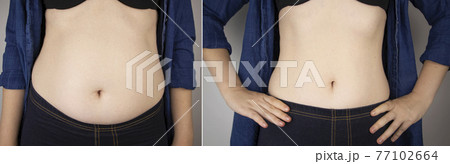 The girl shows the results of work on the body. Before and after a thick and thin waist. In the photo on the left, belly fat is visible. In the photo on the right, a thin waist without extra kilograms 77102664