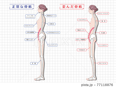 美容カイロの正常な骨格と歪んだ骨格のイラスト素材 美容カイロの正常な骨格と歪んだ骨格のイラスト素材