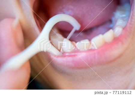 7 years old 77119112