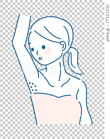 Illustration of a woman with a lumpy armpit Illustration of a woman with a lumpy armpit 77121332