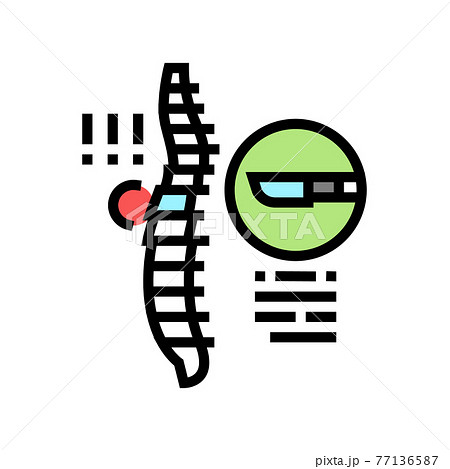 surgery scoliosis color icon vector illustration 77136587