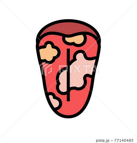 glossitis disease color icon vector illustration 77140485