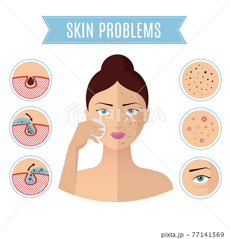 Skin problem solving, acne treatment and cleansing pore for perfect womans face icons Skin problem solving, acne treatment and cleansing pore for perfect womans face icons 77141569