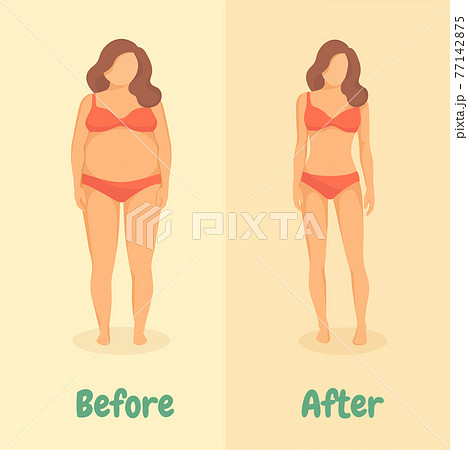 Woman before and after diet or weight loss 77142875