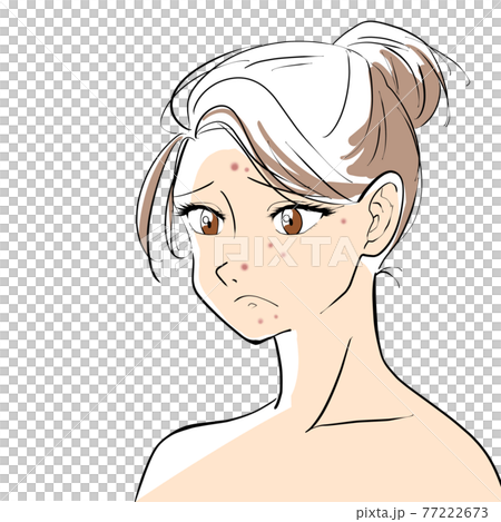 Woman with acne Woman with acne 77222673