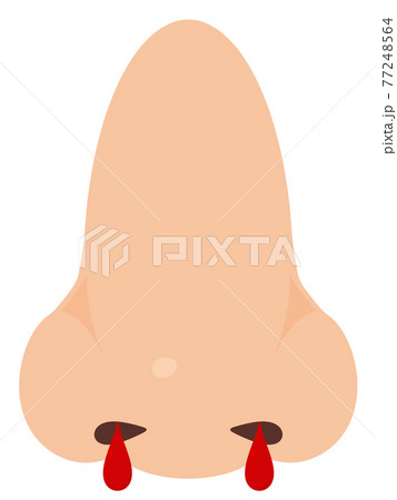 鼻血 77248564