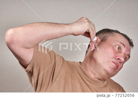 A man instills medicine into his ear with a small pipette from a pharmacy bottle A man instills medicine into his ear with a small pipette from a pharmacy bottle 77252056
