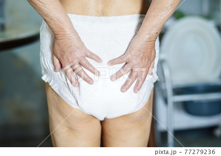 Asian senior or elderly old lady woman patient wearing incontinence diaper in nursing hospital ward Asian senior or elderly old lady woman patient wearing incontinence diaper in nursing hospital ward 77279236