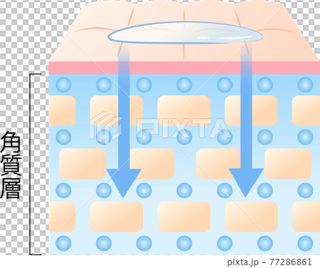 高穿透性皮膚的橫截面圖 77286861
