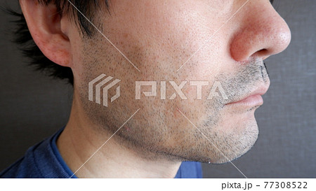 中年男性の髭 77308522