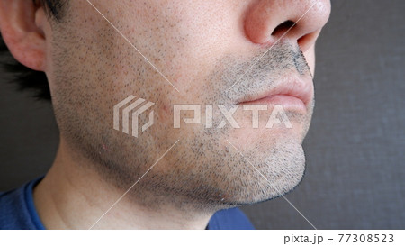 中年男性の髭 中年男性の髭 77308523