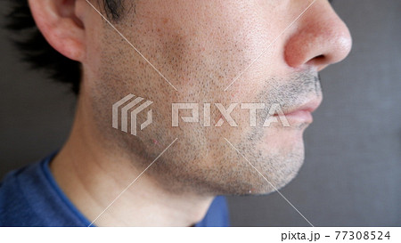 中年男性の髭 77308524