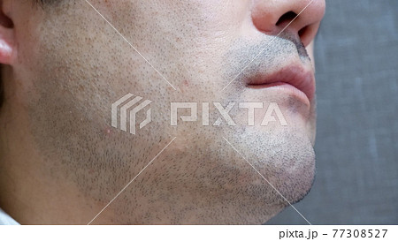 中年男性の髭 77308527