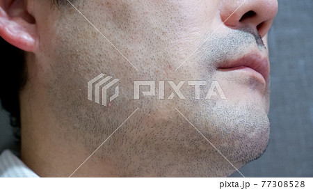 中年男性の髭 中年男性の髭 77308528
