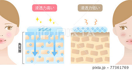 浸透力の高い肌と低い肌　女性　断面図 77361769