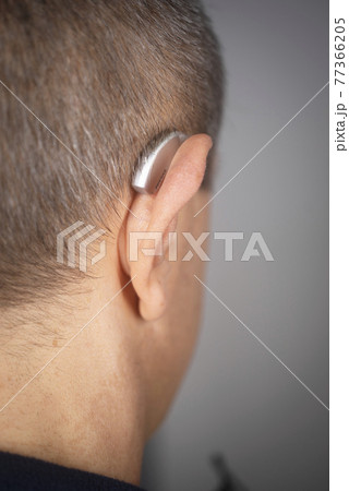 Hearing aid ear of man Hearing aid ear of man 77366205