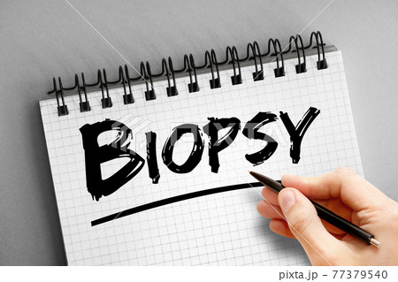 Biopsy text on notepad, concept background Biopsy text on notepad, concept background 77379540