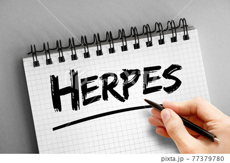 Herpes text on notepad, health concept background 77379780