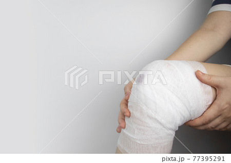 The doctor bandages the knee of a girl who is injured. Stopping bleeding by applying a pressure bandage to the injury. First aid for injuries. The technique of applying a cruciform bandage. 77395291