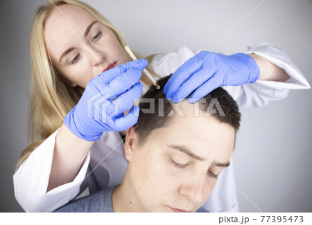 A trichologist doctor drips the serum onto the patient's hair. Treatment of alopecia. Hair loss, alopecia, pruritus, burning head or seborrhea A trichologist doctor drips the serum onto the patient's hair. Treatment of alopecia. Hair loss, alopecia, pruritus, burning head or seborrhea 77395473