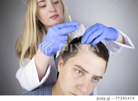 A trichologist doctor drips the serum onto the patient's hair. Treatment of alopecia. Hair loss, alopecia, pruritus, burning head or seborrhea 77395474