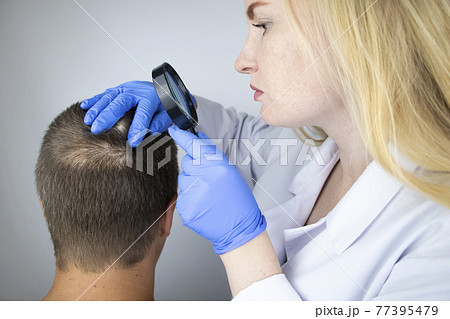 A trichologist examines the hair of a man who begins alopecia. Consultation with a dermatologist. Hair loss, alopecia, pruritus, burning head or seborrhea 77395479