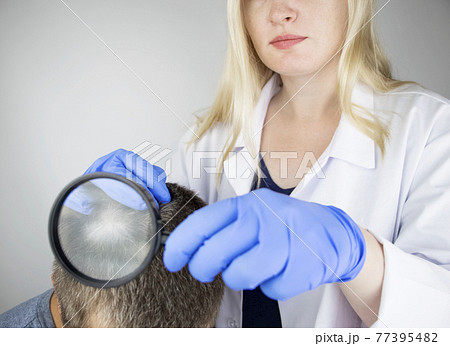 A trichologist examines the hair of a man who begins alopecia. Consultation with a dermatologist. Hair loss, alopecia, pruritus, burning head or seborrhea 77395482
