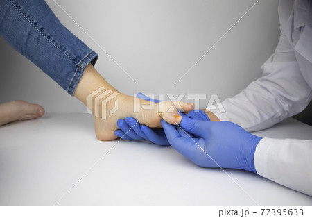 A dermatologist examines a toenail affected by a fungus. Treatment of mycosis and assistance to patients with fungal diseases. 77395633