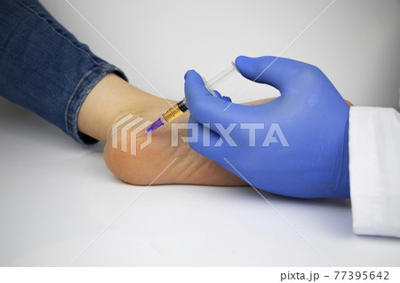 An orthopedic surgeon gives an injection in the heel to relieve pain from a heel spur. The concept of medical care and non-surgical treatments. An orthopedic surgeon gives an injection in the heel to relieve pain from a heel spur. The concept of medical care and non-surgical treatments. 77395642