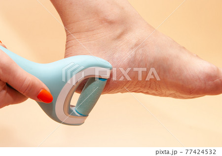 Care and cleansing of the woman feet from rough, flaky skin. An electric foot dead skin remover in a woman's hand grinds foot heel at home. Care and cleansing of the woman feet from rough, flaky skin. An electric foot dead skin remover in a woman's hand grinds foot heel at home. 77424532