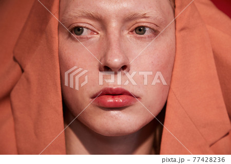 Albino male with womanlike appearance wearing orange jacket at his head 77428236