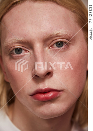 Albino man with feminine appearance and blonde hair looking at camera 77428851