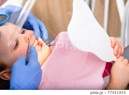 Little girl looking at cured teeth thru the mirror in pediatric dental clinic Little girl looking at cured teeth thru the mirror in pediatric dental clinic 77431954