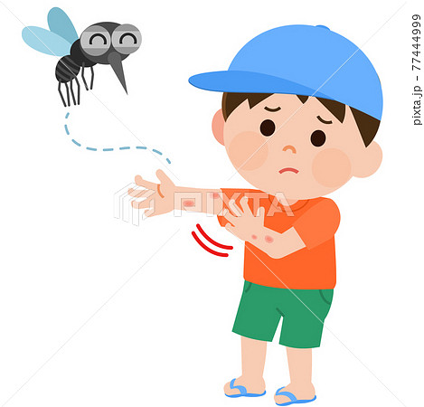 蚊に刺されて腕を掻く男の子 イラストのイラスト素材